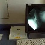 Do your patients ever FAIL your clinical swallow evaluation?