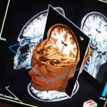 What can fMRI tell us about swallowing?