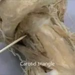 Neck dissection anatomy: Know your anatomy Part 2