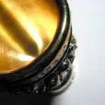 Chin tuck miracle: Holy grail case discussion