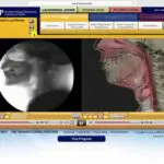 How do I pass the MBSImP (Modified Barium Swallow Impairment Profile)?