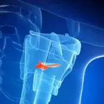 Facing COVID-19: Impact on swallowing in patients following intubation and tracheostomy