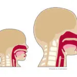Impact of a Tracheostomy on Pressure: Adult and Pediatric Considerations