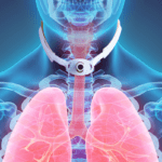 Tracheostomy tube cuff management: The road to decannulation