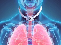 Tracheostomy tube cuff management: The road to decannulation Dysphagia-Tracheostomy