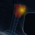 Laryngeal Endoscopy with Videostroboscopy: A Practical Approach for Voice Professionals